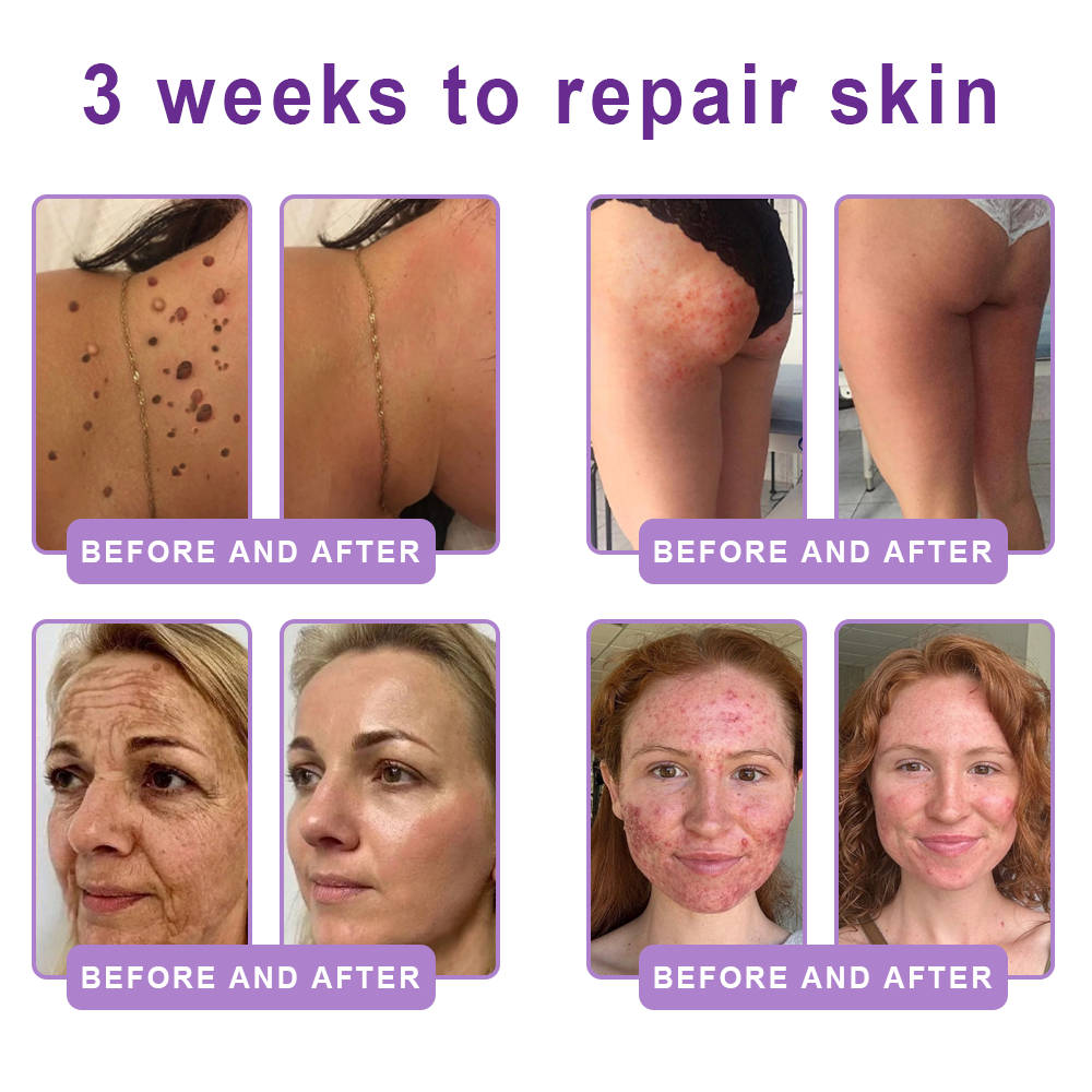 𝐇𝐈𝐒𝐊𝐈𝐍® 𝐏𝐃𝐑𝐍 𝐌𝐮𝐥𝐭𝐢-𝐏𝐞𝐩𝐭𝐢𝐝 𝐁𝐨𝐝𝐲𝐫𝐨𝐥𝐥𝐞𝐫-𝐂𝐫𝐞𝐦𝐞 ✨ 𝐀𝐧𝐭𝐢-𝐀𝐠𝐢𝐧𝐠 · 𝐇𝐚𝐮𝐭𝐬𝐭𝐫𝐚𝐟𝐟𝐮𝐧𝐠 · 𝐅𝐞𝐮𝐜𝐡𝐭𝐢𝐠𝐤𝐞𝐢𝐭 · 𝐇𝐚𝐮𝐭𝐫𝐞𝐩𝐚𝐫𝐚𝐭𝐮𝐫 · 𝐄𝐛𝐞𝐧𝐦äß𝐢𝐠𝐞𝐫 𝐇𝐚𝐮𝐭𝐭𝐨𝐧 💛