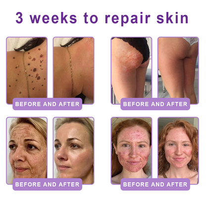 𝐇𝐈𝐒𝐊𝐈𝐍® 𝐏𝐃𝐑𝐍 𝐌𝐮𝐥𝐭𝐢-𝐏𝐞𝐩𝐭𝐢𝐝 𝐁𝐨𝐝𝐲𝐫𝐨𝐥𝐥𝐞𝐫-𝐂𝐫𝐞𝐦𝐞 ✨ 𝐀𝐧𝐭𝐢-𝐀𝐠𝐢𝐧𝐠 · 𝐇𝐚𝐮𝐭𝐬𝐭𝐫𝐚𝐟𝐟𝐮𝐧𝐠 · 𝐅𝐞𝐮𝐜𝐡𝐭𝐢𝐠𝐤𝐞𝐢𝐭 · 𝐇𝐚𝐮𝐭𝐫𝐞𝐩𝐚𝐫𝐚𝐭𝐮𝐫 · 𝐄𝐛𝐞𝐧𝐦äß𝐢𝐠𝐞𝐫 𝐇𝐚𝐮𝐭𝐭𝐨𝐧 💛