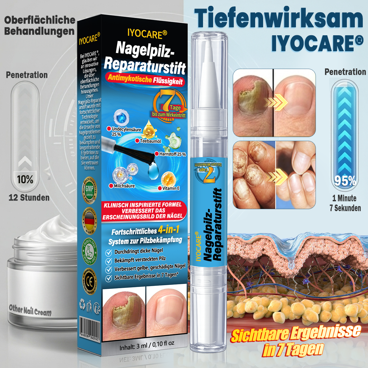 IYOCARE® Nagelpilz Reparatur-Stift Bekämpft die Ursache — Sichtbare Verbesserung in wenigen Tagen* Die meisten Behandlungen bleiben an der Oberfläche. Diese wirkt tiefer.