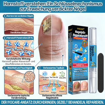 IYOCARE® Nagelpilz Reparatur-Stift Bekämpft die Ursache — Sichtbare Verbesserung in wenigen Tagen* Die meisten Behandlungen bleiben an der Oberfläche. Diese wirkt tiefer.