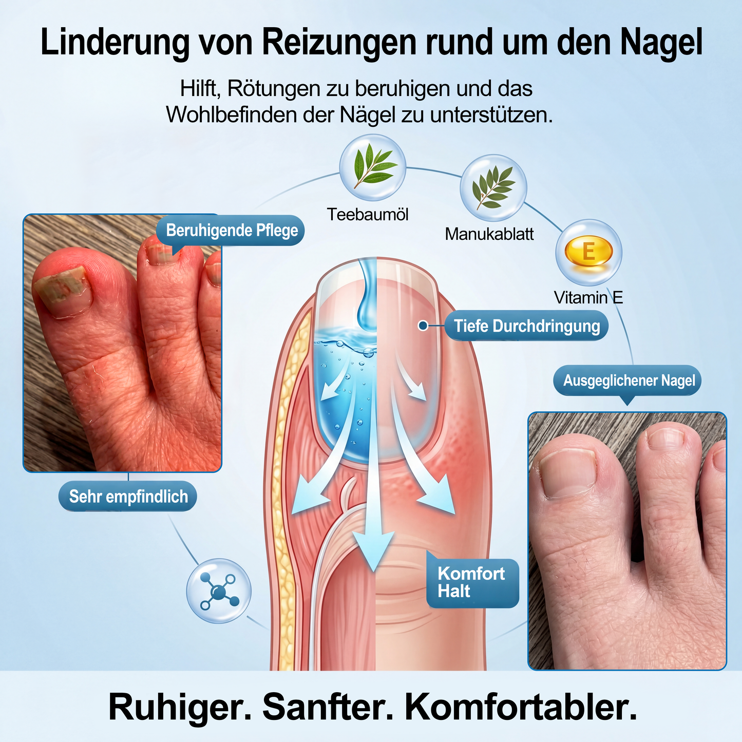 IYOCARE® Nagelpilz Reparatur-Stift Bekämpft die Ursache — Sichtbare Verbesserung in wenigen Tagen* Die meisten Behandlungen bleiben an der Oberfläche. Diese wirkt tiefer.