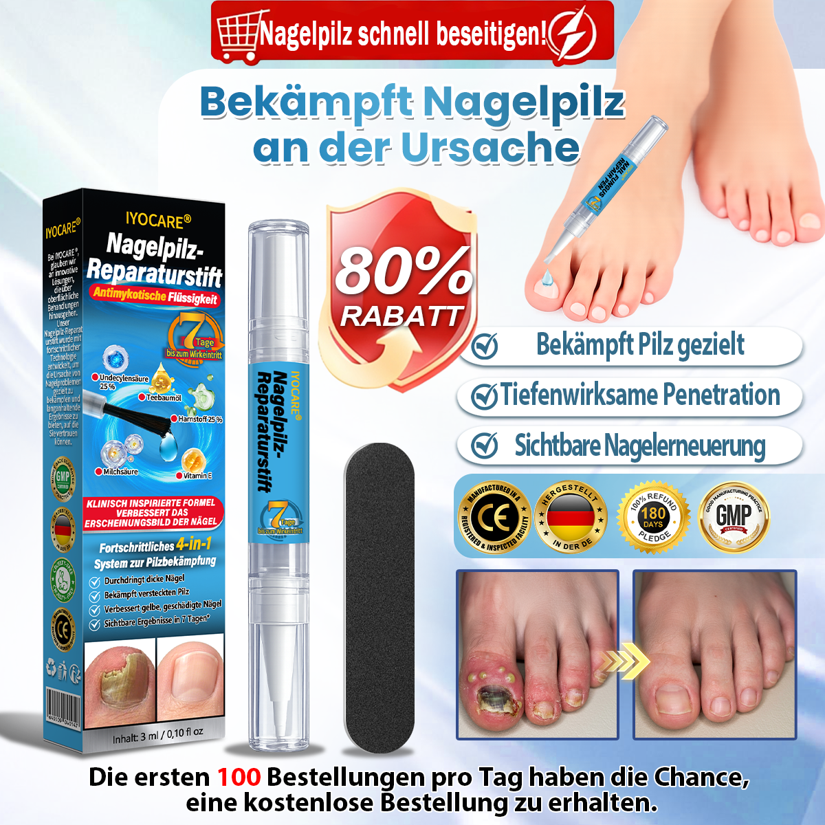 IYOCARE® Nagelpilz Reparatur-Stift Bekämpft die Ursache — Sichtbare Verbesserung in wenigen Tagen* Die meisten Behandlungen bleiben an der Oberfläche. Diese wirkt tiefer.