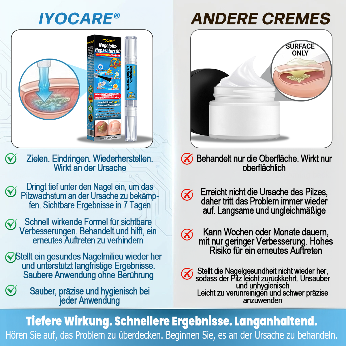 IYOCARE® Nagelpilz Reparatur-Stift Bekämpft die Ursache — Sichtbare Verbesserung in wenigen Tagen* Die meisten Behandlungen bleiben an der Oberfläche. Diese wirkt tiefer.