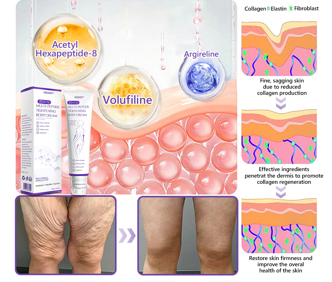 𝐇𝐈𝐒𝐊𝐈𝐍® 𝐏𝐃𝐑𝐍 𝐌𝐮𝐥𝐭𝐢-𝐏𝐞𝐩𝐭𝐢𝐝 𝐁𝐨𝐝𝐲𝐫𝐨𝐥𝐥𝐞𝐫-𝐂𝐫𝐞𝐦𝐞 ✨ 𝐀𝐧𝐭𝐢-𝐀𝐠𝐢𝐧𝐠 · 𝐇𝐚𝐮𝐭𝐬𝐭𝐫𝐚𝐟𝐟𝐮𝐧𝐠 · 𝐅𝐞𝐮𝐜𝐡𝐭𝐢𝐠𝐤𝐞𝐢𝐭 · 𝐇𝐚𝐮𝐭𝐫𝐞𝐩𝐚𝐫𝐚𝐭𝐮𝐫 · 𝐄𝐛𝐞𝐧𝐦äß𝐢𝐠𝐞𝐫 𝐇𝐚𝐮𝐭𝐭𝐨𝐧 💛
