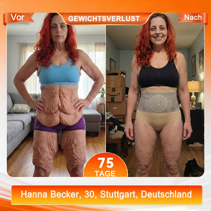 deOffizieller Marken-Store 💎 𝑨𝑳𝑳𝒀𝑩𝑬𝑬® 2026 Moringa & Berberin 4-in-1 Mikropartikel Shaping- & Fat-Burn-Shorts