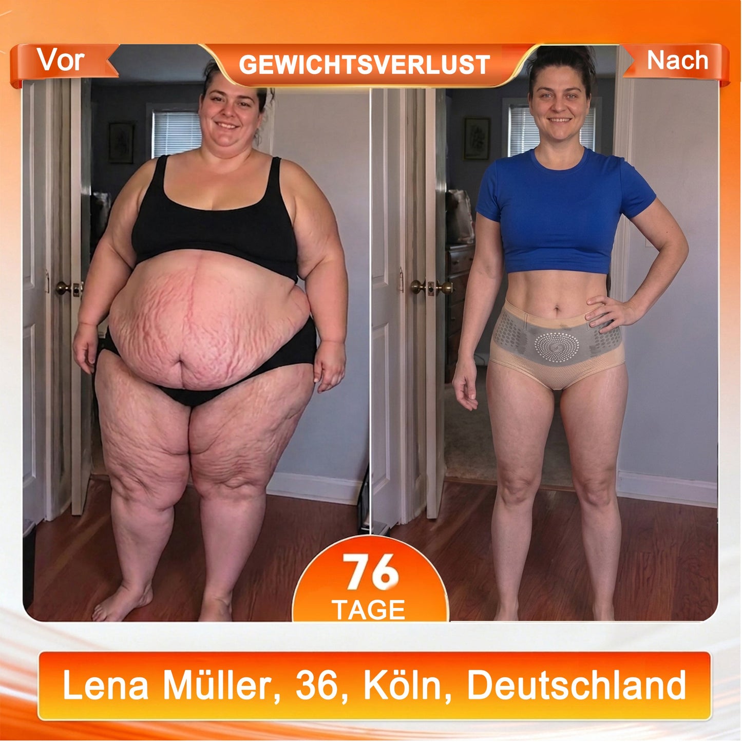 deOffizieller Marken-Store 💎 𝑨𝑳𝑳𝒀𝑩𝑬𝑬® 2026 Moringa & Berberin 4-in-1 Mikropartikel Shaping- & Fat-Burn-Shorts