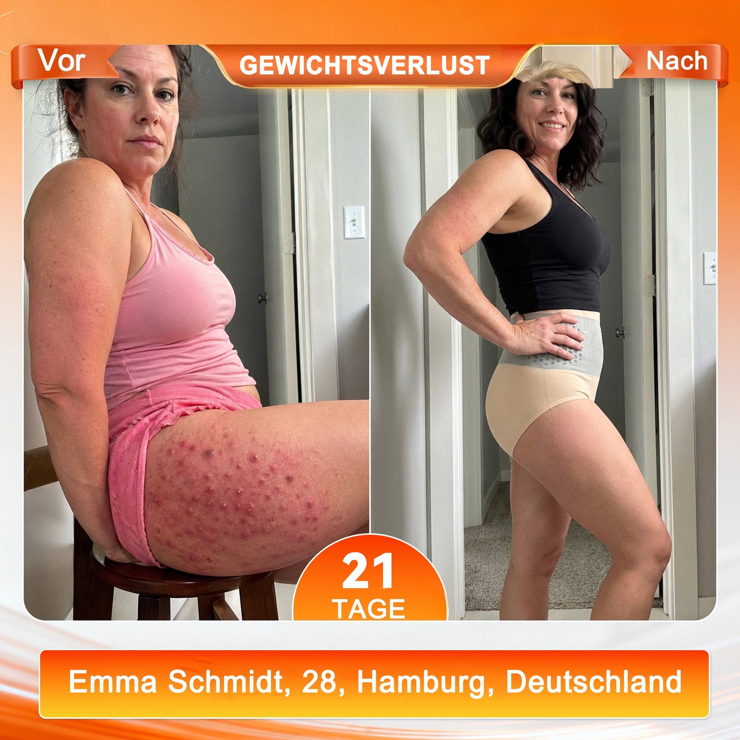 deOffizieller Marken-Store 💎 𝑨𝑳𝑳𝒀𝑩𝑬𝑬® 2026 Moringa & Berberin 4-in-1 Mikropartikel Shaping- & Fat-Burn-Shorts
