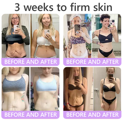 𝐇𝐈𝐒𝐊𝐈𝐍® 𝐏𝐃𝐑𝐍 𝐌𝐮𝐥𝐭𝐢-𝐏𝐞𝐩𝐭𝐢𝐝 𝐁𝐨𝐝𝐲𝐫𝐨𝐥𝐥𝐞𝐫-𝐂𝐫𝐞𝐦𝐞 ✨ 𝐀𝐧𝐭𝐢-𝐀𝐠𝐢𝐧𝐠 · 𝐇𝐚𝐮𝐭𝐬𝐭𝐫𝐚𝐟𝐟𝐮𝐧𝐠 · 𝐅𝐞𝐮𝐜𝐡𝐭𝐢𝐠𝐤𝐞𝐢𝐭 · 𝐇𝐚𝐮𝐭𝐫𝐞𝐩𝐚𝐫𝐚𝐭𝐮𝐫 · 𝐄𝐛𝐞𝐧𝐦äß𝐢𝐠𝐞𝐫 𝐇𝐚𝐮𝐭𝐭𝐨𝐧 💛