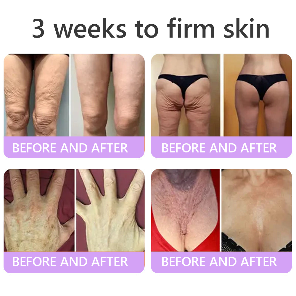 𝐇𝐈𝐒𝐊𝐈𝐍® 𝐏𝐃𝐑𝐍 𝐌𝐮𝐥𝐭𝐢-𝐏𝐞𝐩𝐭𝐢𝐝 𝐁𝐨𝐝𝐲𝐫𝐨𝐥𝐥𝐞𝐫-𝐂𝐫𝐞𝐦𝐞 ✨ 𝐀𝐧𝐭𝐢-𝐀𝐠𝐢𝐧𝐠 · 𝐇𝐚𝐮𝐭𝐬𝐭𝐫𝐚𝐟𝐟𝐮𝐧𝐠 · 𝐅𝐞𝐮𝐜𝐡𝐭𝐢𝐠𝐤𝐞𝐢𝐭 · 𝐇𝐚𝐮𝐭𝐫𝐞𝐩𝐚𝐫𝐚𝐭𝐮𝐫 · 𝐄𝐛𝐞𝐧𝐦äß𝐢𝐠𝐞𝐫 𝐇𝐚𝐮𝐭𝐭𝐨𝐧 💛