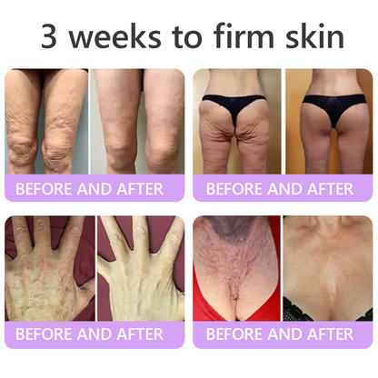 𝐇𝐈𝐒𝐊𝐈𝐍® 𝐏𝐃𝐑𝐍 𝐌𝐮𝐥𝐭𝐢-𝐏𝐞𝐩𝐭𝐢𝐝 𝐁𝐨𝐝𝐲𝐫𝐨𝐥𝐥𝐞𝐫-𝐂𝐫𝐞𝐦𝐞 ✨ 𝐀𝐧𝐭𝐢-𝐀𝐠𝐢𝐧𝐠 · 𝐇𝐚𝐮𝐭𝐬𝐭𝐫𝐚𝐟𝐟𝐮𝐧𝐠 · 𝐅𝐞𝐮𝐜𝐡𝐭𝐢𝐠𝐤𝐞𝐢𝐭 · 𝐇𝐚𝐮𝐭𝐫𝐞𝐩𝐚𝐫𝐚𝐭𝐮𝐫 · 𝐄𝐛𝐞𝐧𝐦äß𝐢𝐠𝐞𝐫 𝐇𝐚𝐮𝐭𝐭𝐨𝐧 💛
