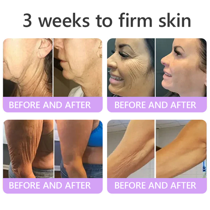 𝐇𝐈𝐒𝐊𝐈𝐍® 𝐏𝐃𝐑𝐍 𝐌𝐮𝐥𝐭𝐢-𝐏𝐞𝐩𝐭𝐢𝐝 𝐁𝐨𝐝𝐲𝐫𝐨𝐥𝐥𝐞𝐫-𝐂𝐫𝐞𝐦𝐞 ✨ 𝐀𝐧𝐭𝐢-𝐀𝐠𝐢𝐧𝐠 · 𝐇𝐚𝐮𝐭𝐬𝐭𝐫𝐚𝐟𝐟𝐮𝐧𝐠 · 𝐅𝐞𝐮𝐜𝐡𝐭𝐢𝐠𝐤𝐞𝐢𝐭 · 𝐇𝐚𝐮𝐭𝐫𝐞𝐩𝐚𝐫𝐚𝐭𝐮𝐫 · 𝐄𝐛𝐞𝐧𝐦äß𝐢𝐠𝐞𝐫 𝐇𝐚𝐮𝐭𝐭𝐨𝐧 💛