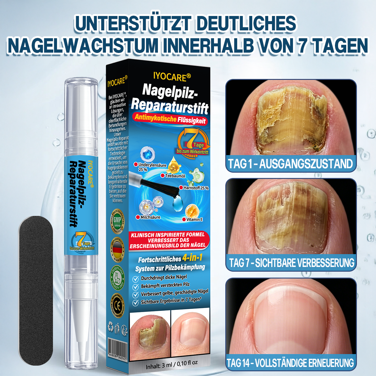 IYOCARE® Nagelpilz Reparatur-Stift Bekämpft die Ursache — Sichtbare Verbesserung in wenigen Tagen* Die meisten Behandlungen bleiben an der Oberfläche. Diese wirkt tiefer.