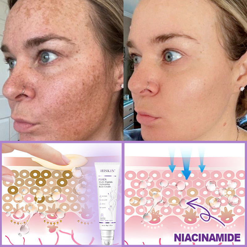 𝐇𝐈𝐒𝐊𝐈𝐍® 𝐏𝐃𝐑𝐍 𝐌𝐮𝐥𝐭𝐢-𝐏𝐞𝐩𝐭𝐢𝐝 𝐁𝐨𝐝𝐲𝐫𝐨𝐥𝐥𝐞𝐫-𝐂𝐫𝐞𝐦𝐞 ✨ 𝐀𝐧𝐭𝐢-𝐀𝐠𝐢𝐧𝐠 · 𝐇𝐚𝐮𝐭𝐬𝐭𝐫𝐚𝐟𝐟𝐮𝐧𝐠 · 𝐅𝐞𝐮𝐜𝐡𝐭𝐢𝐠𝐤𝐞𝐢𝐭 · 𝐇𝐚𝐮𝐭𝐫𝐞𝐩𝐚𝐫𝐚𝐭𝐮𝐫 · 𝐄𝐛𝐞𝐧𝐦äß𝐢𝐠𝐞𝐫 𝐇𝐚𝐮𝐭𝐭𝐨𝐧 💛