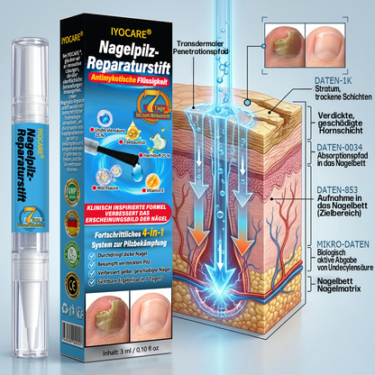 IYOCARE® Nagelpilz Reparatur-Stift Bekämpft die Ursache — Sichtbare Verbesserung in wenigen Tagen* Die meisten Behandlungen bleiben an der Oberfläche. Diese wirkt tiefer.