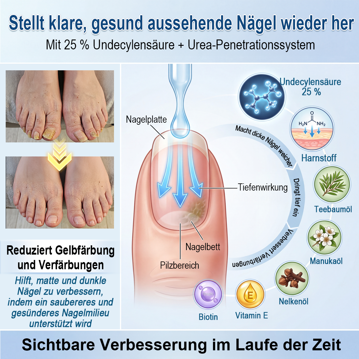 IYOCARE® Nagelpilz Reparatur-Stift Bekämpft die Ursache — Sichtbare Verbesserung in wenigen Tagen* Die meisten Behandlungen bleiben an der Oberfläche. Diese wirkt tiefer.