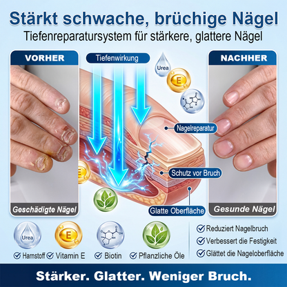 IYOCARE® Nagelpilz Reparatur-Stift Bekämpft die Ursache — Sichtbare Verbesserung in wenigen Tagen* Die meisten Behandlungen bleiben an der Oberfläche. Diese wirkt tiefer.